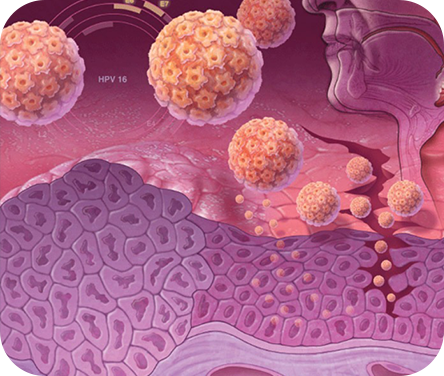 Анализ крови на ВПЧ и рак шейки матки, кольпоскопия цена- CMD